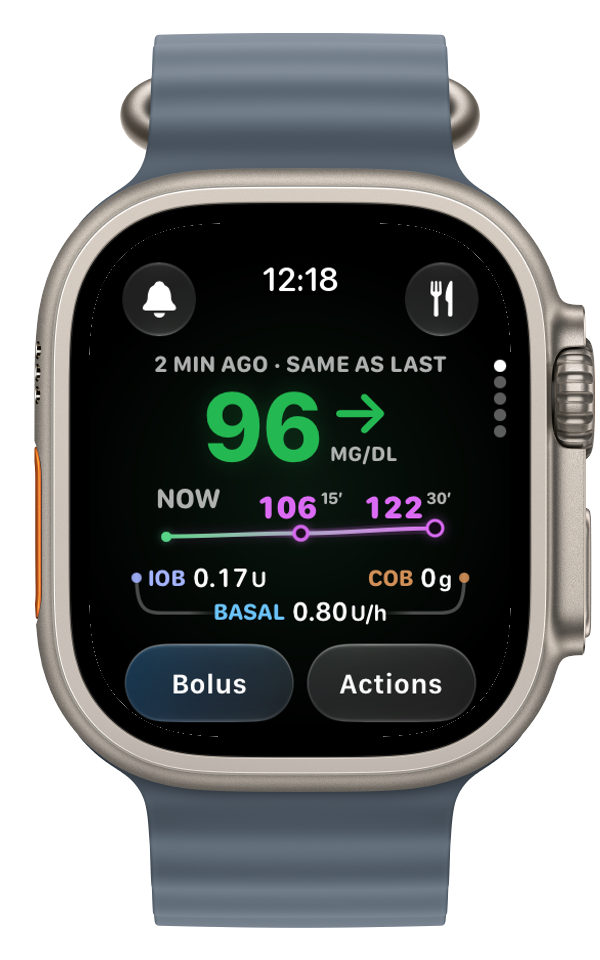 GlucoFusion on Apple Watch Ultra 3 showing glucose and upcoming predictions with fictional demo data.